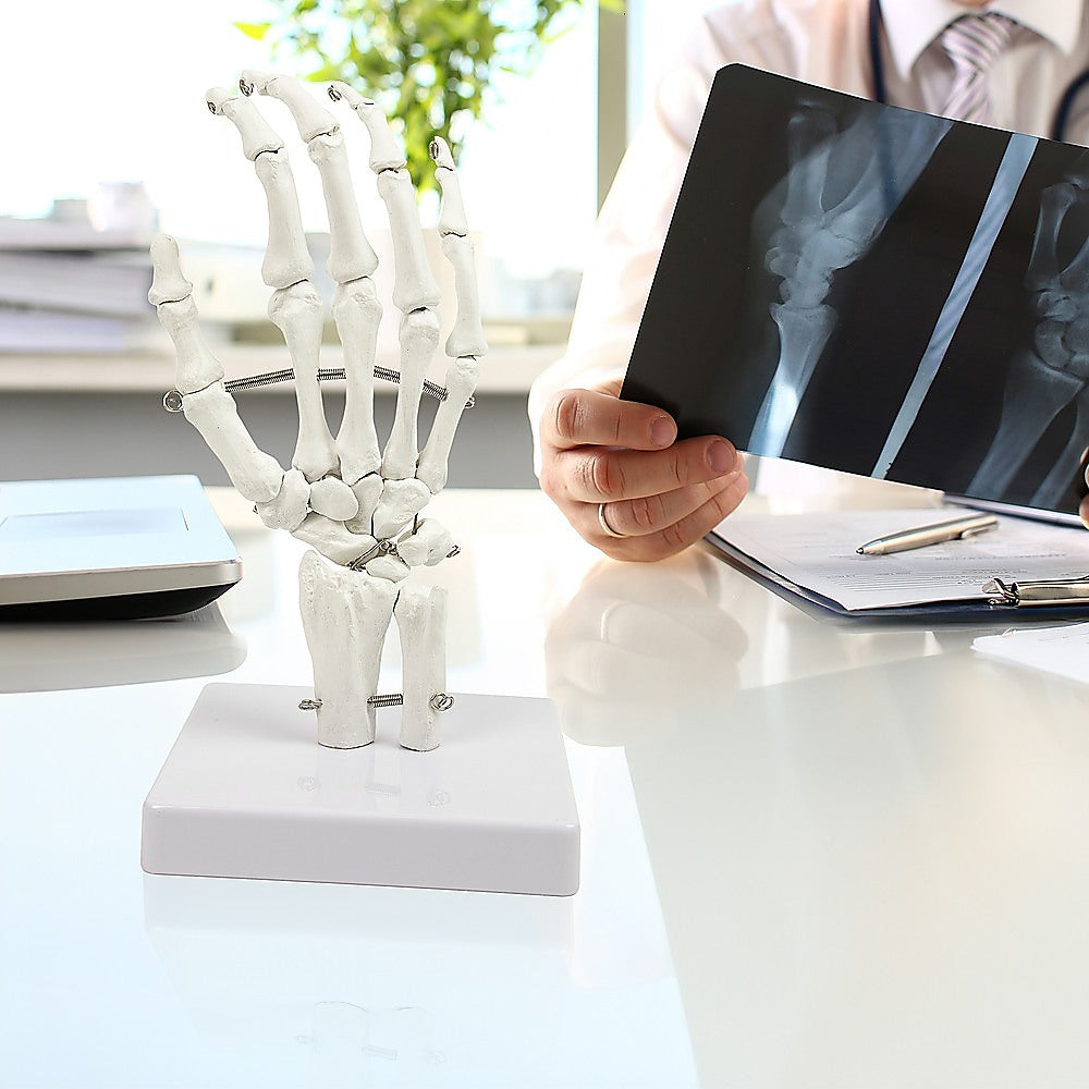 Hand Joint Anatomical Skeleton Model Human Anatomy Study Tool Secondary image